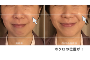 頬の位置がわからない方へ