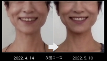 笑顔：頬が上がって口元リラックス