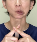 下顎しか動いていない
