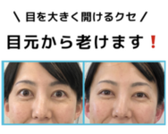 目を大きく開けるクセにご注意